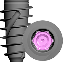 Implant 1