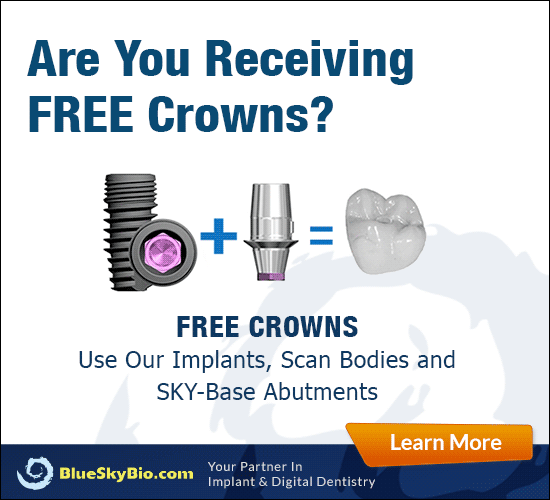 Free Crowns